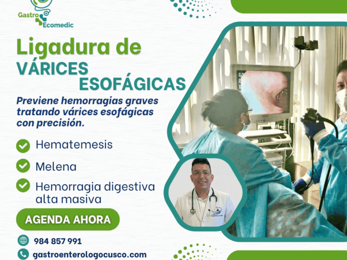 Ligadura de várices esofágicas en Cusco